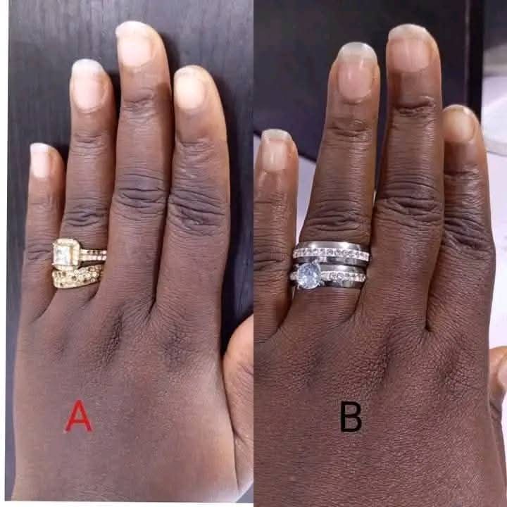 How to Wear Engagement and Wedding Rings in Ghana The Correct Way Explained